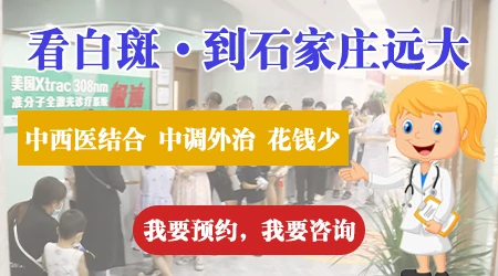 石家庄哪家医院治疗白癜风有权威