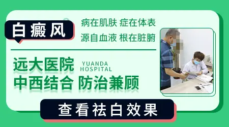 中药治疗白癜风有哪些常用方剂或中成药