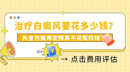 治疗白癜风一般需要多少钱