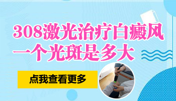 308激光一个光斑有多大