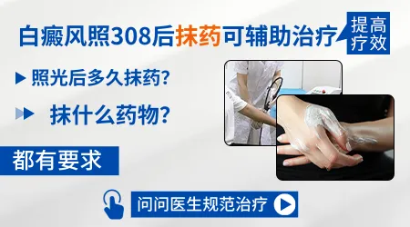 308激光烤过白斑后抹什么药好