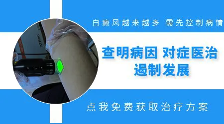 儿童身上的白癜风白斑数量突然变多怎么能控制住