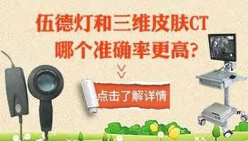 白斑是不是白癜风做什么检查 花多少钱