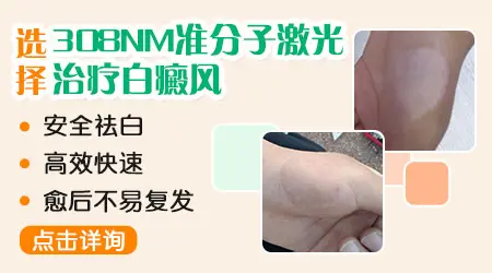 308准激光治疗白斑有效果图