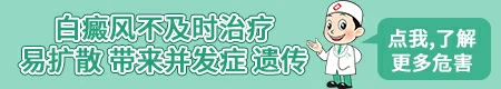 白癜风一年会扩散多少 如何避免白斑扩散