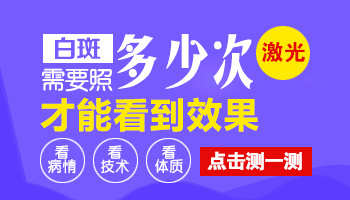 308激光照面部白癜风需要多少次