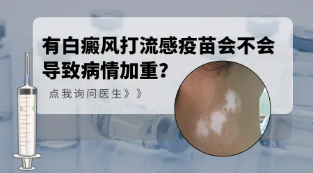 白癜风患者可以打流感疫苗吗