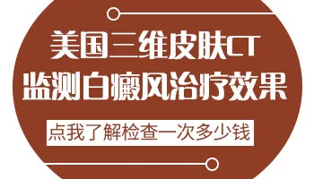在治疗的期间白癜风会越来越白吗