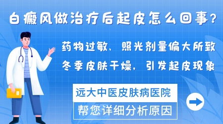 白癜风308照光后蜕皮怎么回事