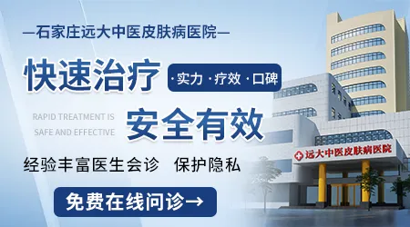 白癜风红痒起水泡还能继续光疗吗