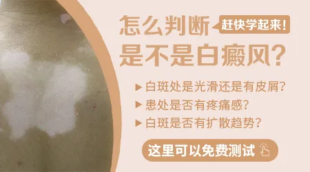 脸上长了块白色的斑不痛不痒会是白癜风吗
