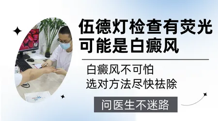 伍德灯检查看不到荧光就不是白癜风对吗