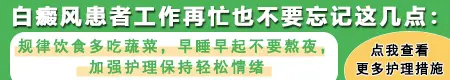 喝中药治疗白癜风什么时候可以停药