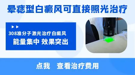 308激光治疗晕痣型白癜风效果怎么样