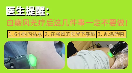 白癜风照308激光后更白了怎么回事