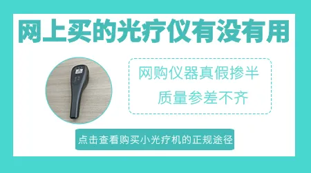 在网上买308光疗仪器有用吗 家用光疗机照白癜风图