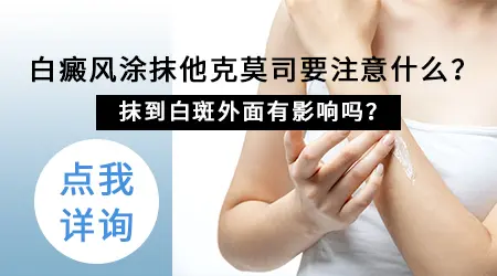 他克莫司软膏治疗白癜风效果怎么样