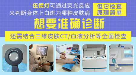 我院常用来检查白斑白点的仪器伍德灯，检查时不接触孩子的皮肤，