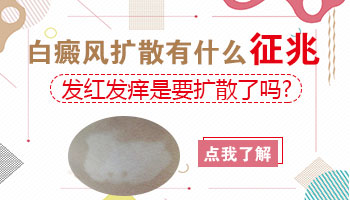 白癜风治疗过程中发红发痒是正常的吗