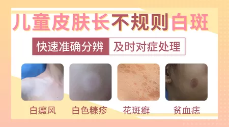 孩子手臂上出现小白点图
