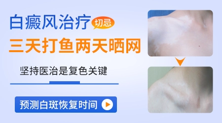 白癜风初期靶向治疗是什么