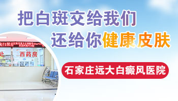 衡水白斑如何能治的好 衡水专门治白斑的医院