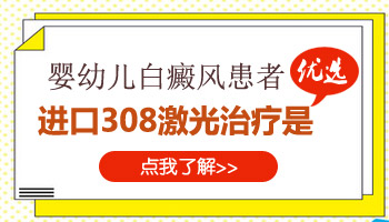 婴幼儿身上白癜风照激光效果好不好