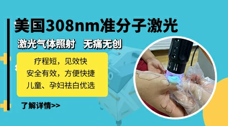 极速308激光治疗白癜风的价格表