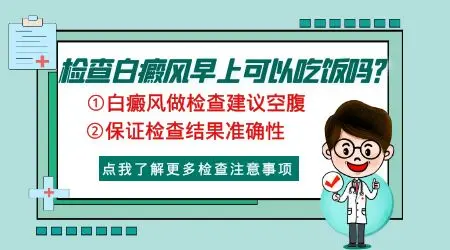 白癜风能治好吗 白斑像是白癜风做哪些检查