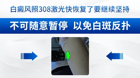 孕妇白斑可以接受308激光治疗吗
