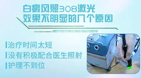白癜风照光疗一年了还要照吗效果一般