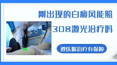 白癜风自己在家照308激光管用吗