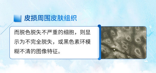 北京专家来啦!!特邀北京白癜风专家——苏有明教授将于4月5日来院会诊