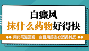 白癜风抹药后白斑发痒怎么回事