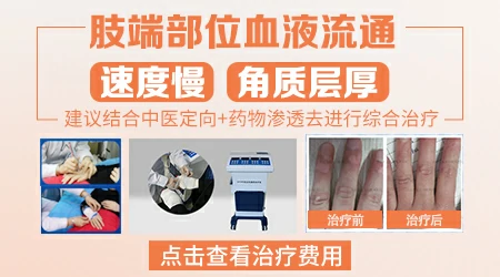 肢端型白癜风是不是治不好了