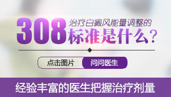 308准分子治疗仪器照白斑是不是能量越高越好