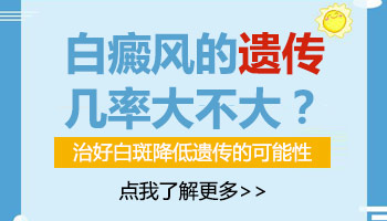 白癜风晚期要孩子会影响吗