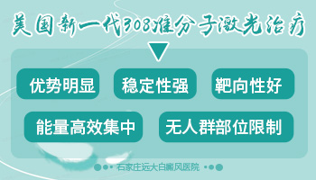 眼睛周边白癜风照308激光对眼睛有伤害吗