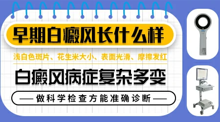 脖子浅白色白斑图片