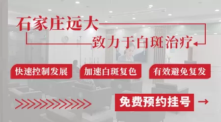 石家庄有没有专门治白癜风好的医院