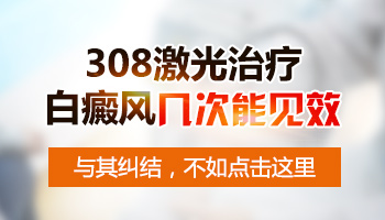 做激光308几次白斑能好