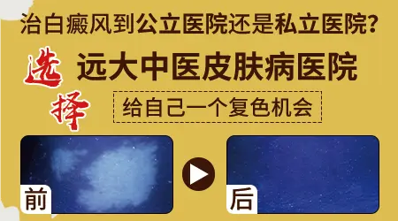 白癜风早期症状图片