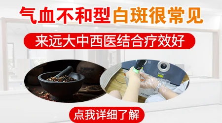 石家庄有没有专门的白癜风专科医院