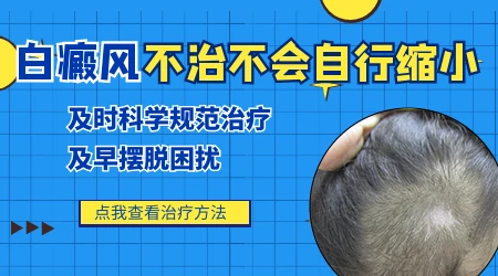 白癜风不治疗会有什么后果