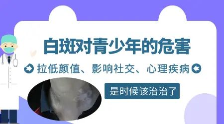 白癜风会影响寿命吗 对身体其他器官有危害吗