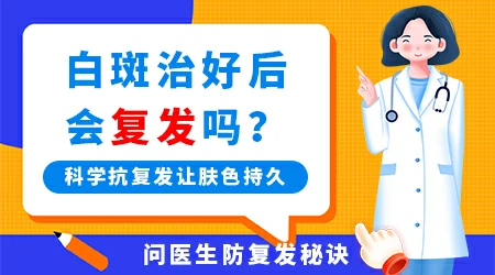 怎么治疗白癜风不会复发