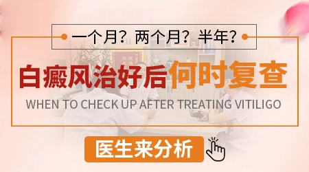 白癜风每次伍德灯复查需要全身照吗