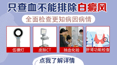 血常规检查能查出白癜风的病因吗