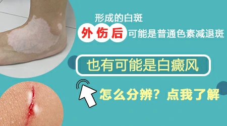 皮肤外伤后长出白斑是怎么回事