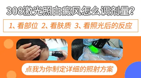 白癜风光疗效果和发病部位有关系吗